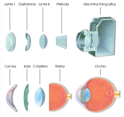 Lussazione del Cristallino: Approcci Chirurgici nelle Contusioni Oculari Post-Traumatiche